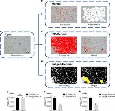 Combination Usage of AdipoCount and Image-Pro Plus/ImageJ Software for Quantification of Adipocyte Sizes